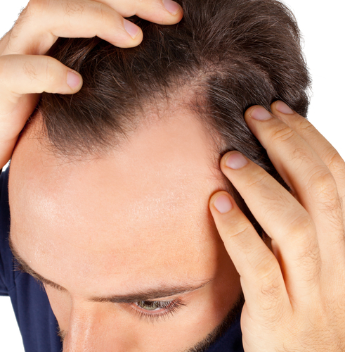 Hair-Loss-Treatments-And-Solutions-For-Men