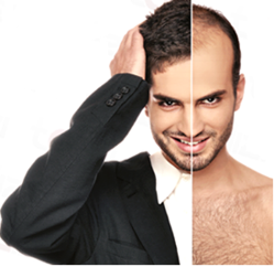 hair-transplant-treatment-services-250x250.png